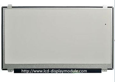 পরিধানযোগ্য স্মার্ট ওয়াচের জন্য MCU SPI ইন্টারফেস IPS স্কয়ার TFT ডিসপ্লে মডিউল